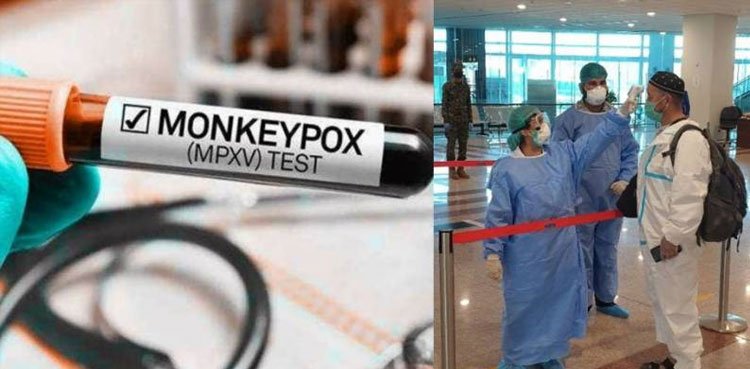 Pakistan, monkeypox case, Saudi Arabia