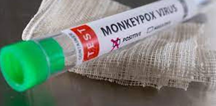 monkeypox case, Pakistan, mpox